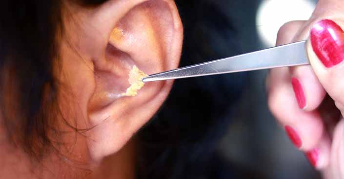 What Causes Earwax Build Up
