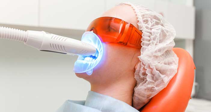 Laser Teeth Whitening Price